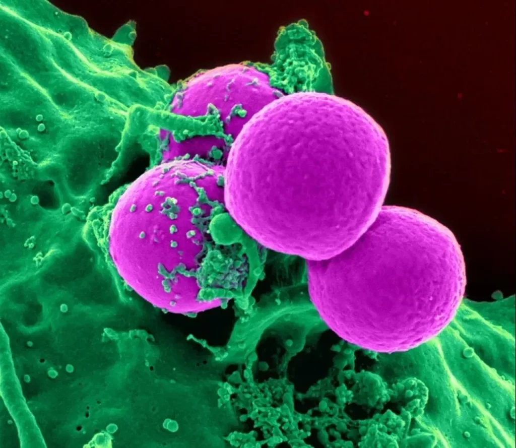 Your Body And It's Immune System
